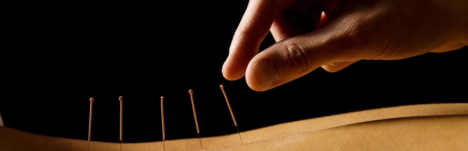 North Bay Naturopath Acupuncture and Traditional Chinese Medicine