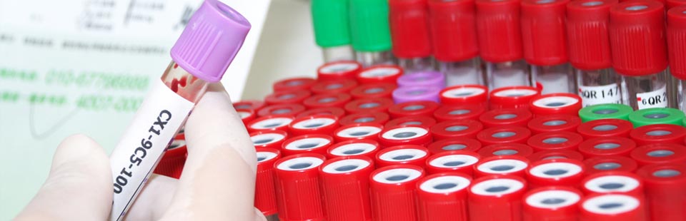North Bay Naturopath Blood Work